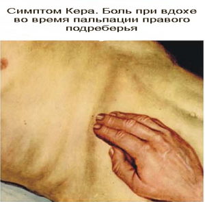 может ли болеть весь живот при холецистите