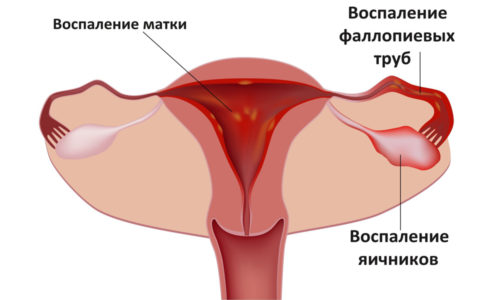 во время овуляции боли как при цистите